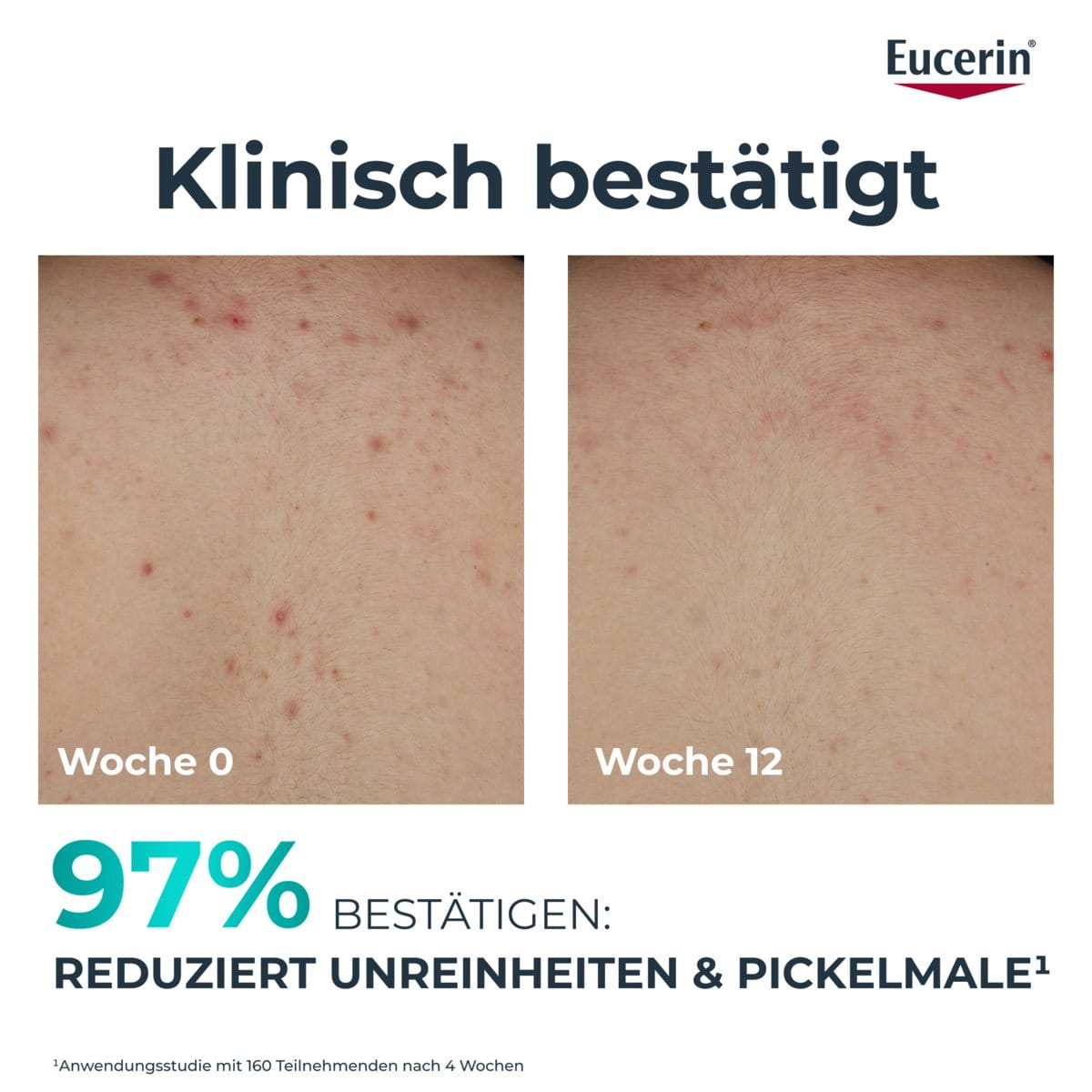 DERMOPURE CLINICAL ERNEUERNDE KÖRPERPFLEGE – Bild 8
