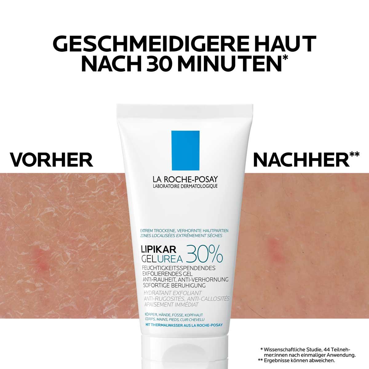 LIPIKARGEL UREA 30&nbsp;% – Bild 7