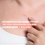 Narbenpflege-Gel – Bild 10