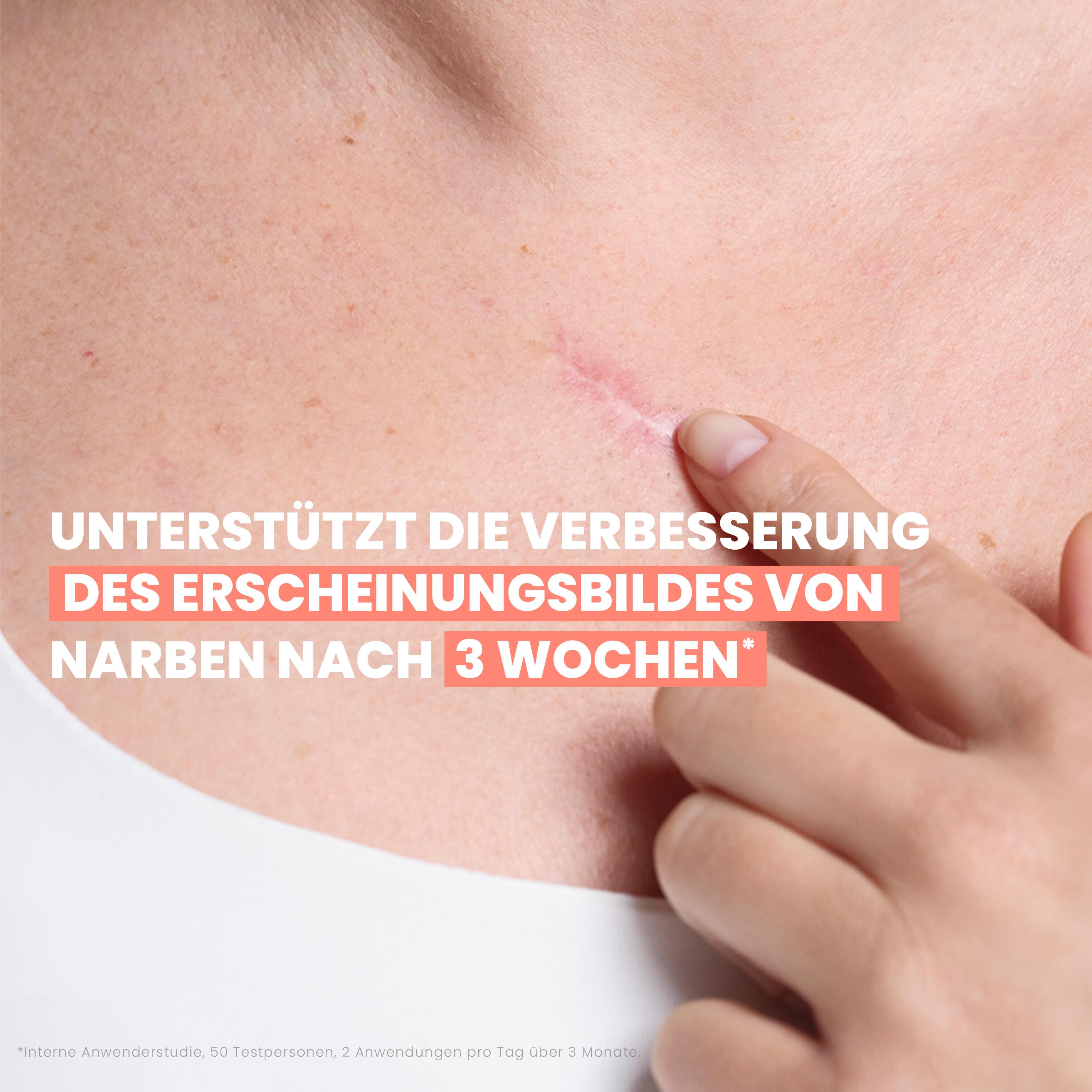 Narbenpflege-Gel – Bild 10